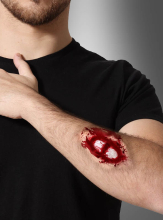 Wunde offener Knochenbruch 