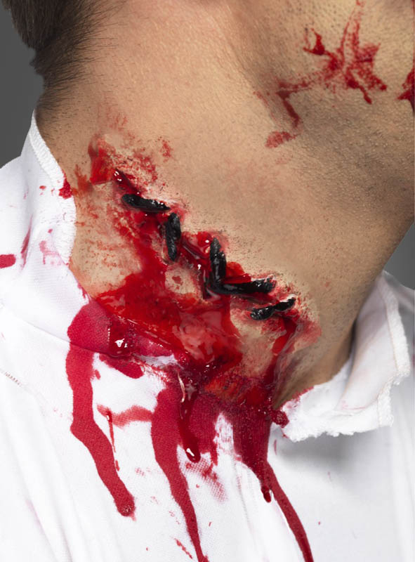 Stitches Scar