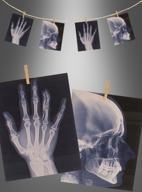 X-Ray Garland