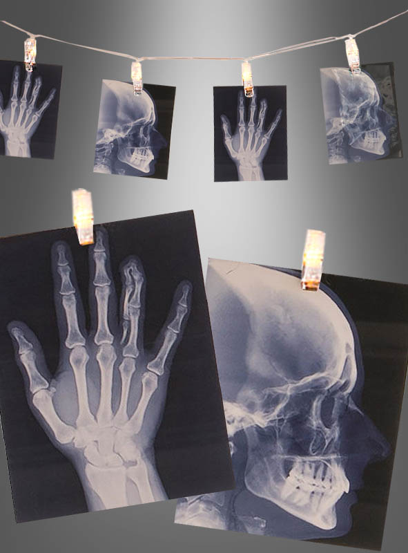 Röntgenbilder Lichterkette Deko hier bei » Kostümpalast