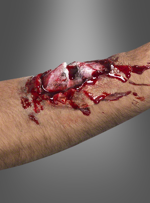 Product image 1 of the product “Latex Wound Broken Bone ”