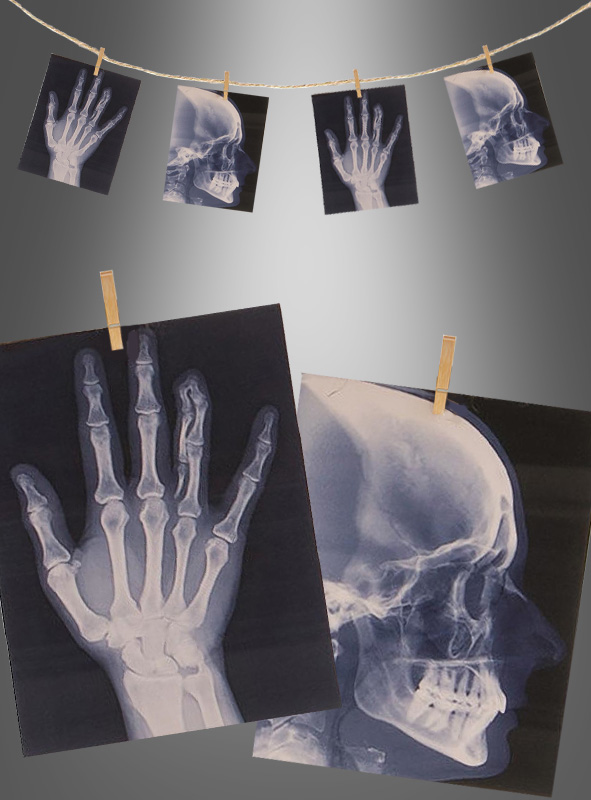 Artikelbild 1 des Artikels “Röntgenbilder Kette 160cm ohne Licht “