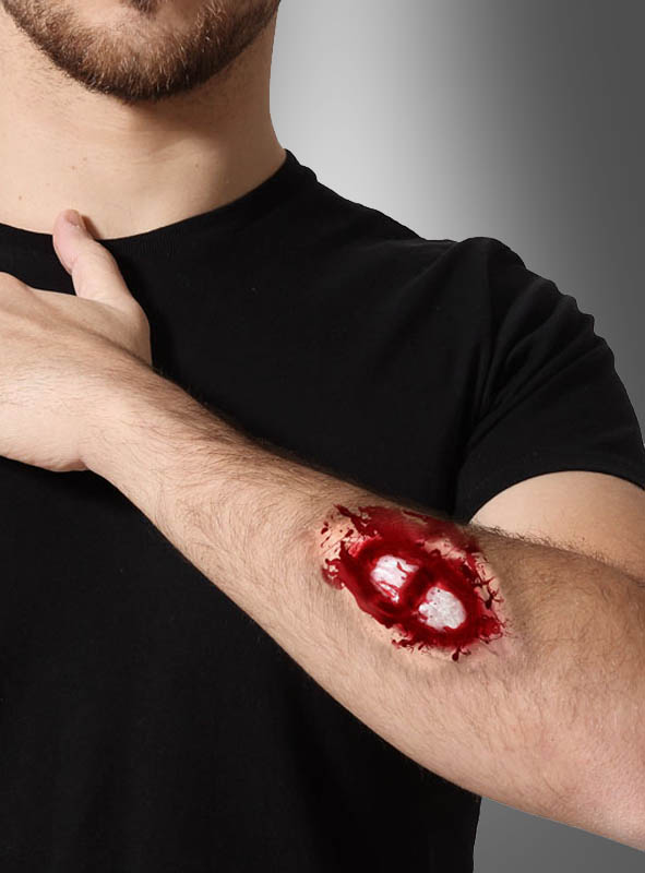 Artikelbild 1 des Artikels “Wunde offener Knochenbruch “