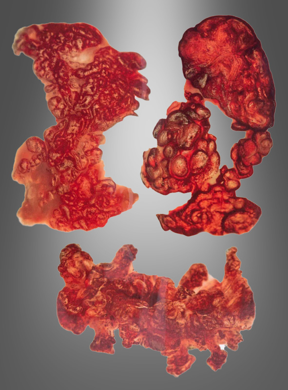 Product image 2 of the product “Burns tattoo ”